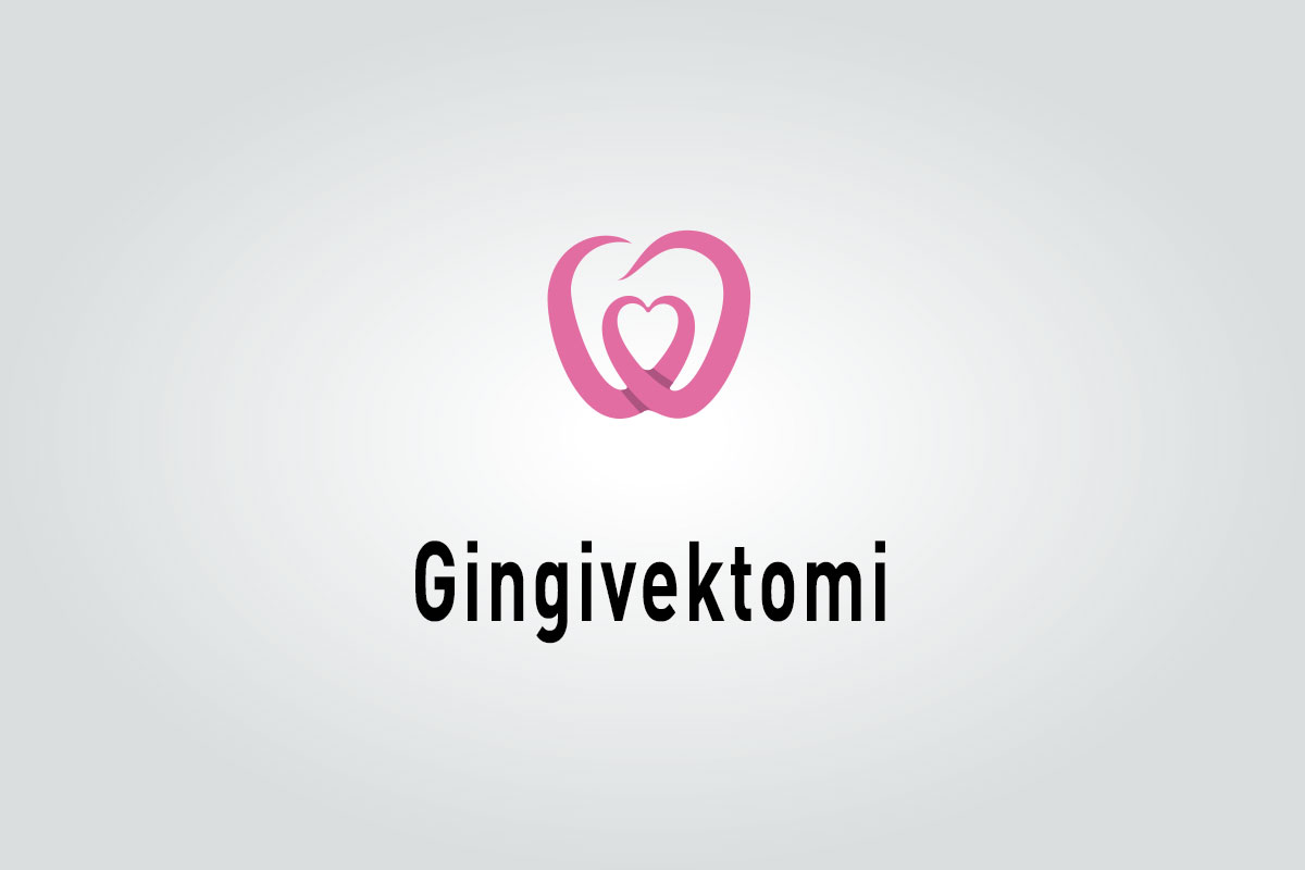 Gingivektomi